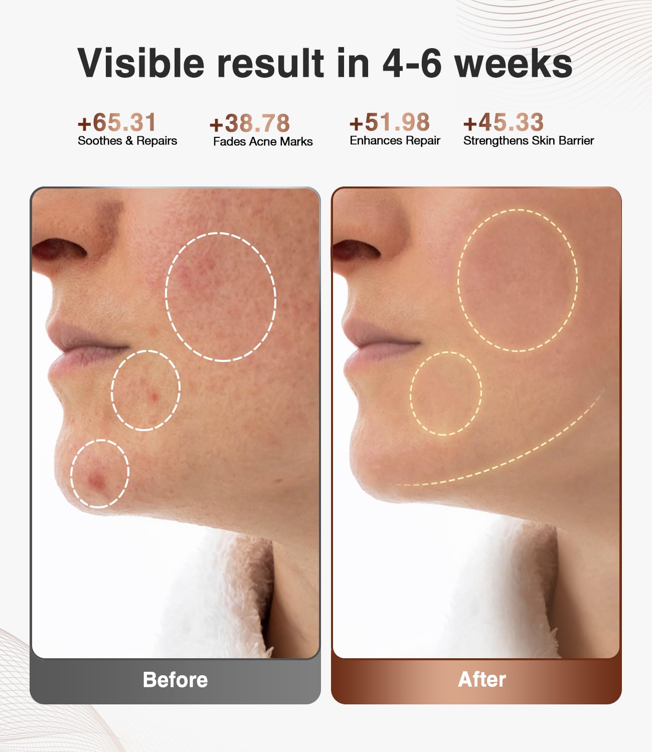 High-Performance 3D LED Beauty Mask – 4 Light Modes, 328 LEDs, Wireless Operation, Adjustable Timer, Lightweight & Flexible Fit – Reveal Radiant Skin (Brown)