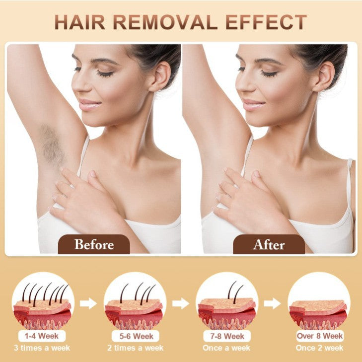 IPL Hair Removal Device - 3-in-1 Permanent Hair Reduction, Skin Rejuvenation & Acne Control(white)