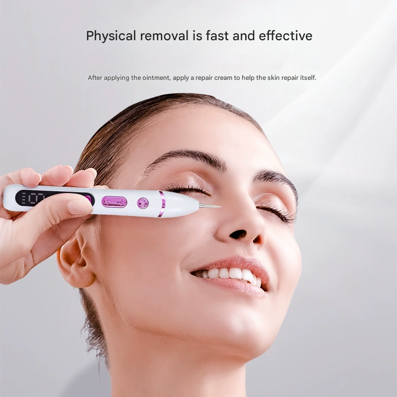 Professional Electric Mole & Dark Spot Remover Pen - Advanced Plasma Ion Technology for Seamless Skin Tag & Freckle Removal (Gold)