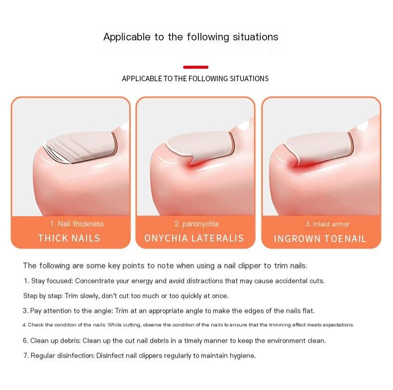 So he carried folding nail clippers-Black Mini cat and Keychain