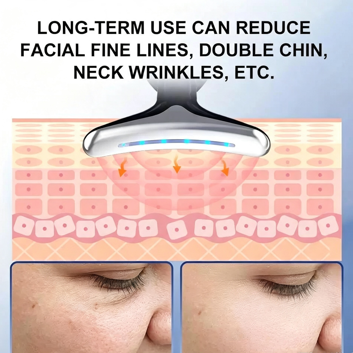 Rejuvenation Massager Neck Anti Wrinkle Face Beauty Device Skin Lifting Tighten White