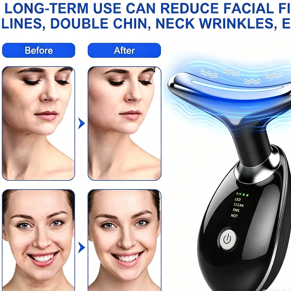 Rejuvenation Massager Neck Anti Wrinkle Face Beauty Device Skin Lifting Tighten Black