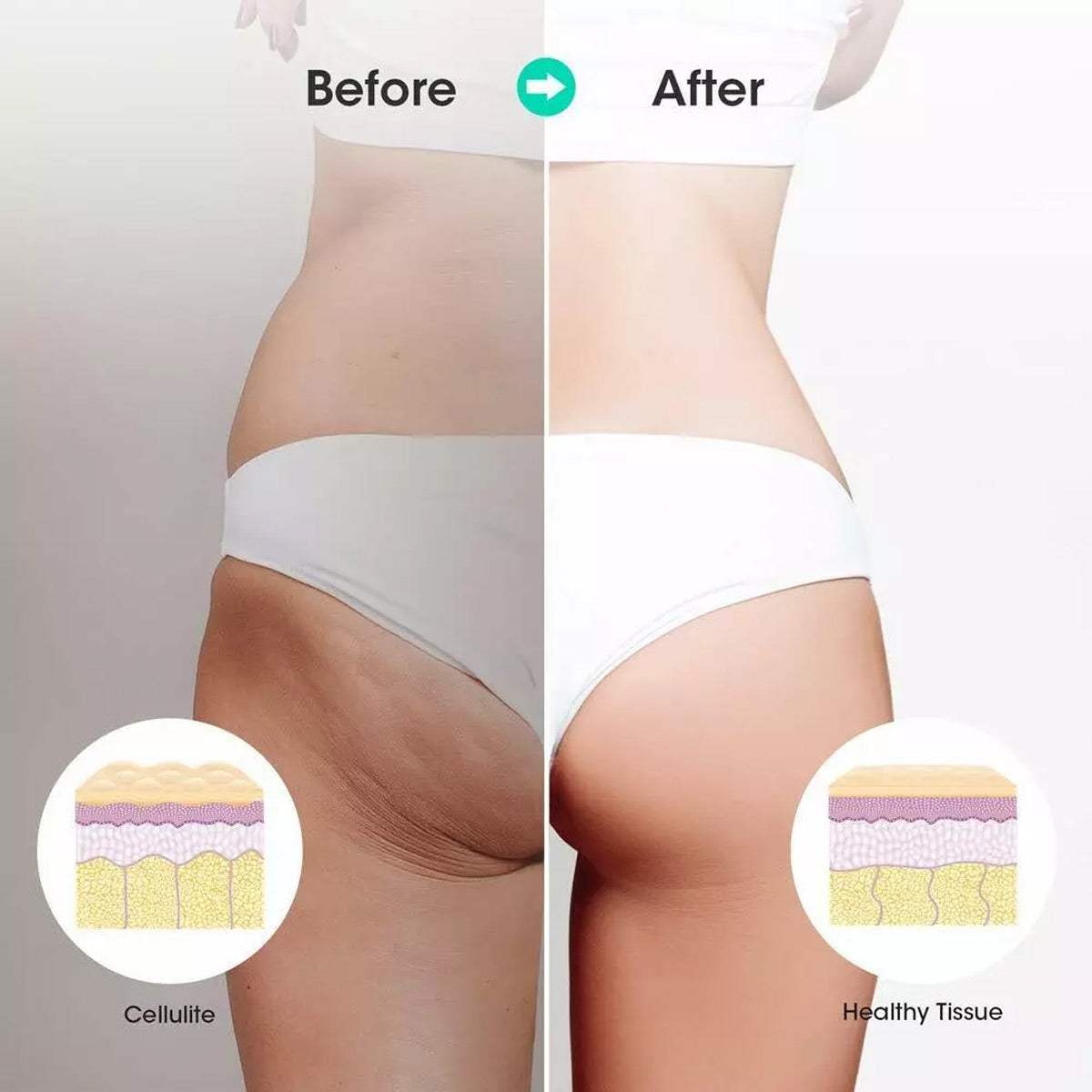 Muscle Roller Stick Full Body Fitness Massage Tool for Home and Gym Use - Green