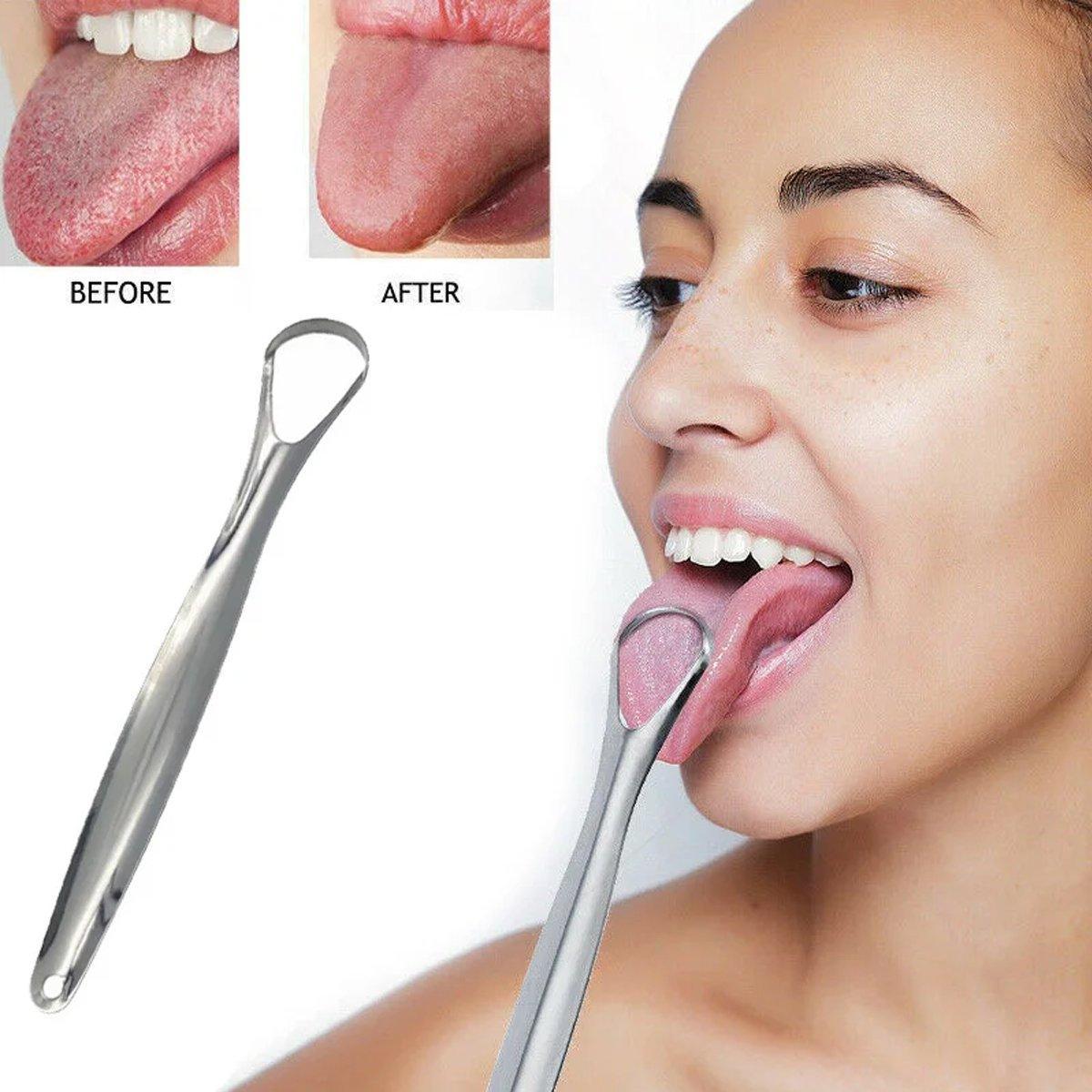 2pcs Stainless Steel Tongue Scraper Oral Tools Tongue Coating Cleaner Device
