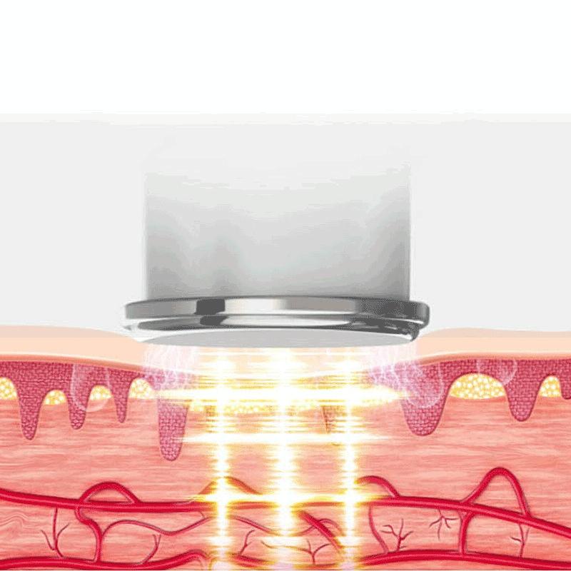 Hot Compress Shoulder & Neck Massager 2 Ends White