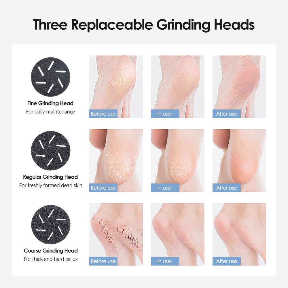 White Rechargeable Electric Foot Grinder with Suction - Complete 10-Piece Pedicure Kit