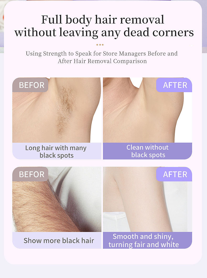 5-in-1 Electric Lady Shaver & Grooming Kit - LCD Display, USB-C Rechargeable, Full Body Hair Removal(Yellow)