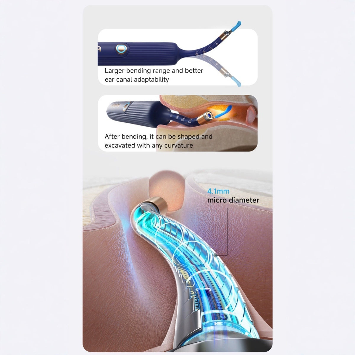 Smart Visual Ear Cleaner with HD Endoscope & Precision Tweezers - Safe for Adults & Children(white)