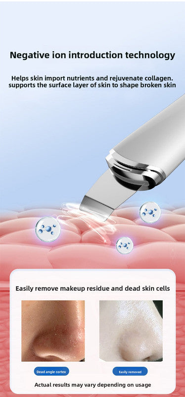 Ultrasonic Skin Scrubber Facial Spatula Blackhead Remover & Pore Cleaner with Ion EMS Lifting Mode Rechargeable Beauty Tool Ivory White