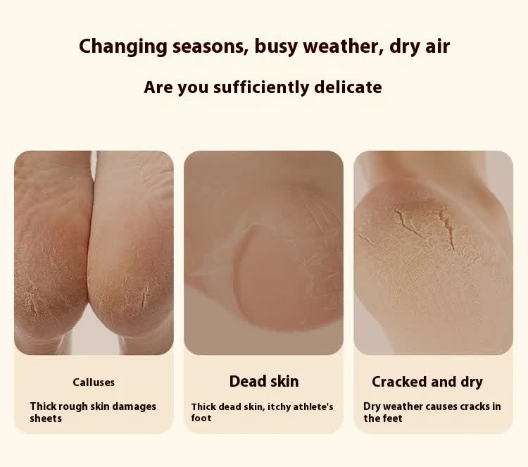 Electric Foot Callus Remover Rechargeable Pedicure Tool with 3 Grinding Heads Portable Dead Skin Exfoliator Peach Pink