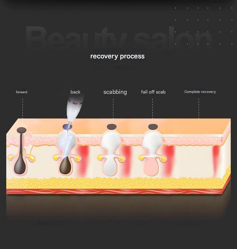 Professional Electric Mole & Dark Spot Remover Pen - Advanced Plasma Ion Technology for Seamless Skin Tag & Freckle Removal (Gold)