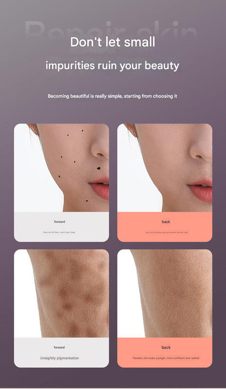 Professional Electric Mole & Dark Spot Remover Pen - Advanced Plasma Ion Technology for Seamless Skin Tag & Freckle Removal (Purple)